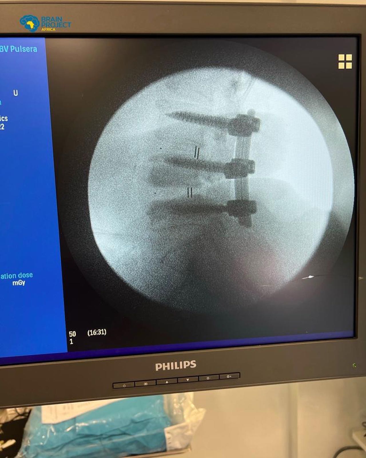 Medical Instrument With Problems Orthopedics Medical Assistant | Next Generation Orthopedic and Spine ...